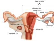 Причины возникновения внематочной беременности В чем причина внематочной беременности