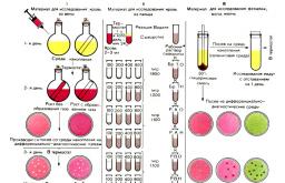 Род Сальмонелла – методы обнаружения сальмонелл в патологическом материале и продуктах Бактериологические методы исследования